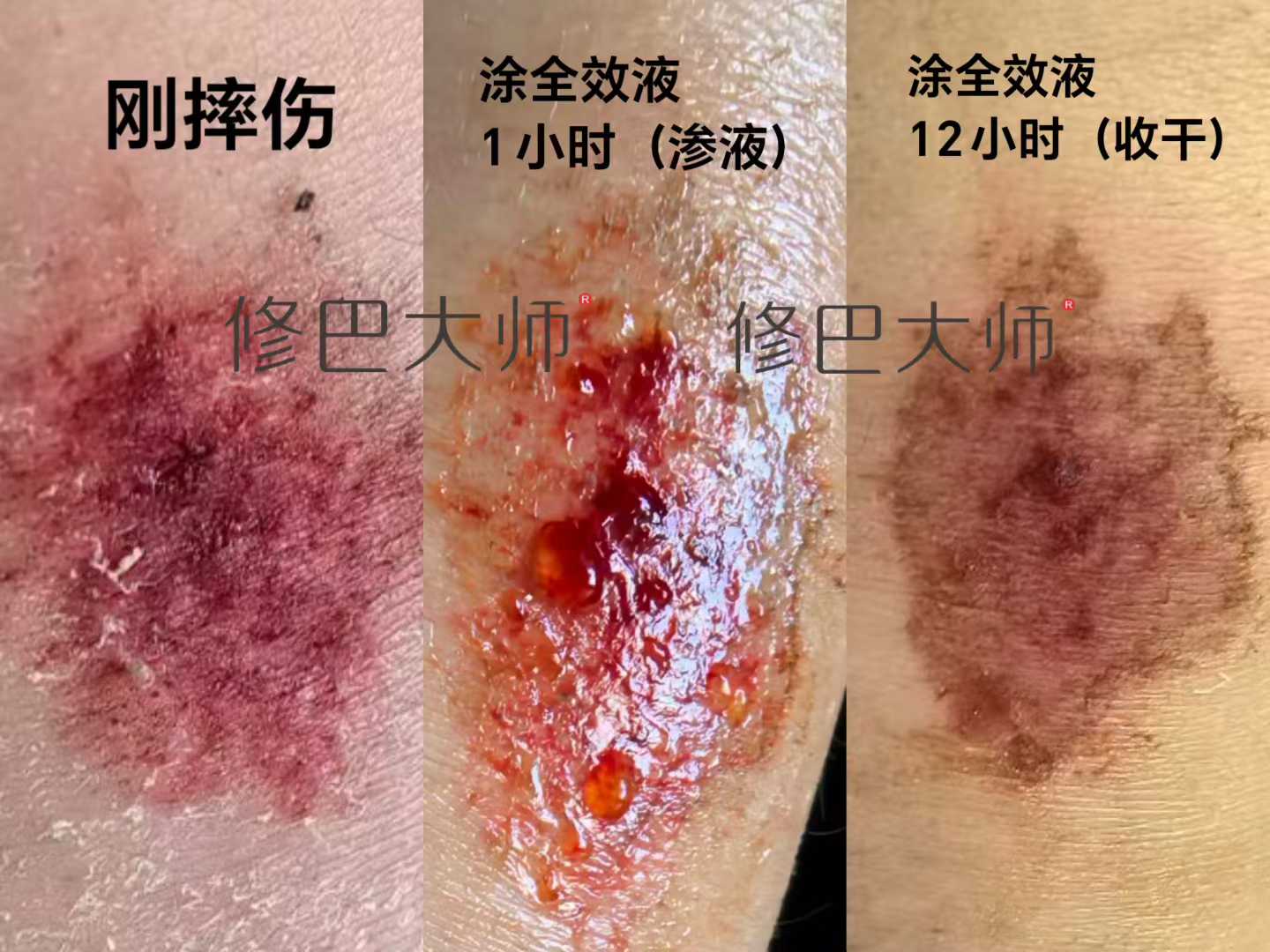 全效液强大的修复能力！