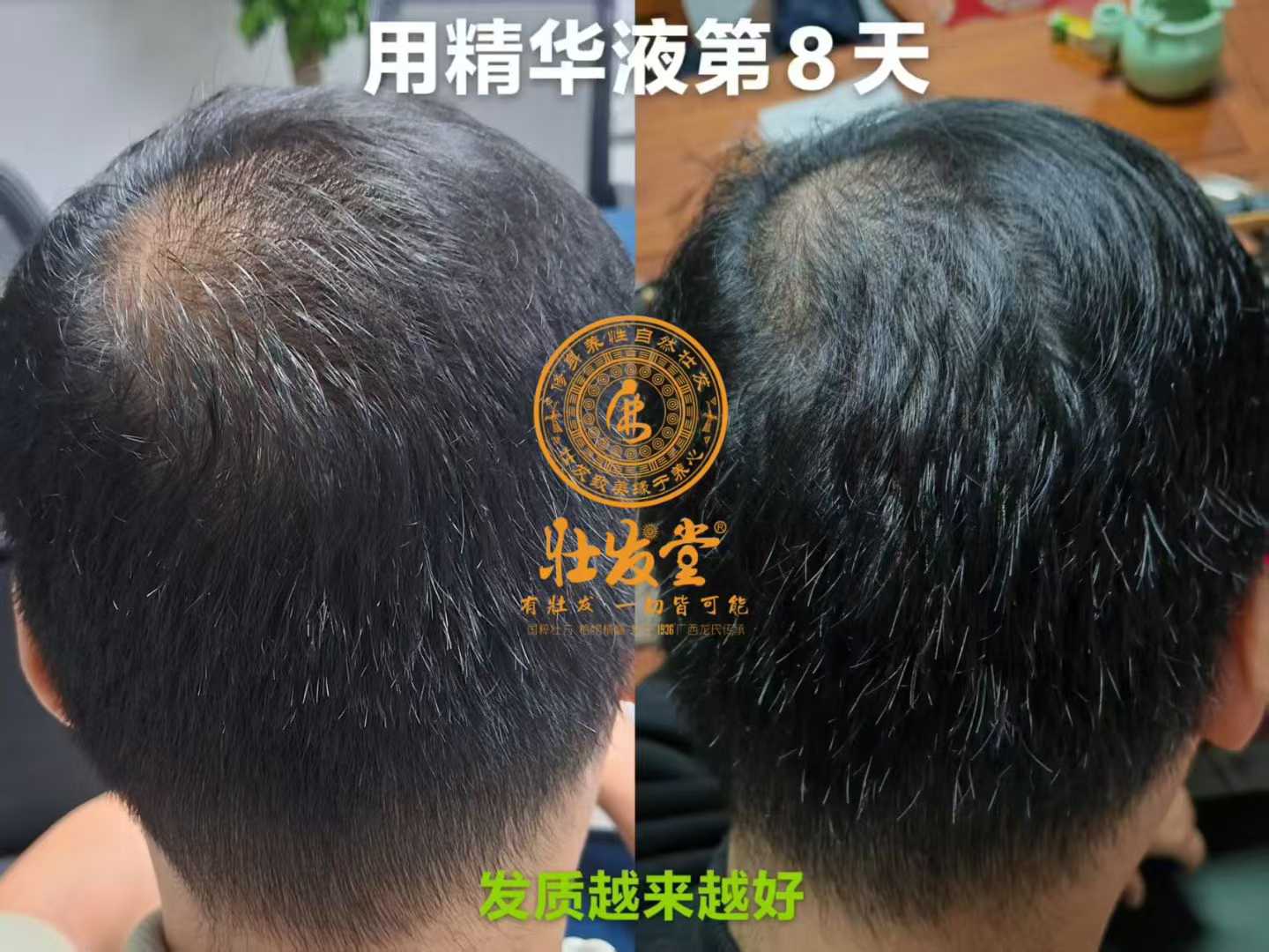 壮发堂生发打卡第8天