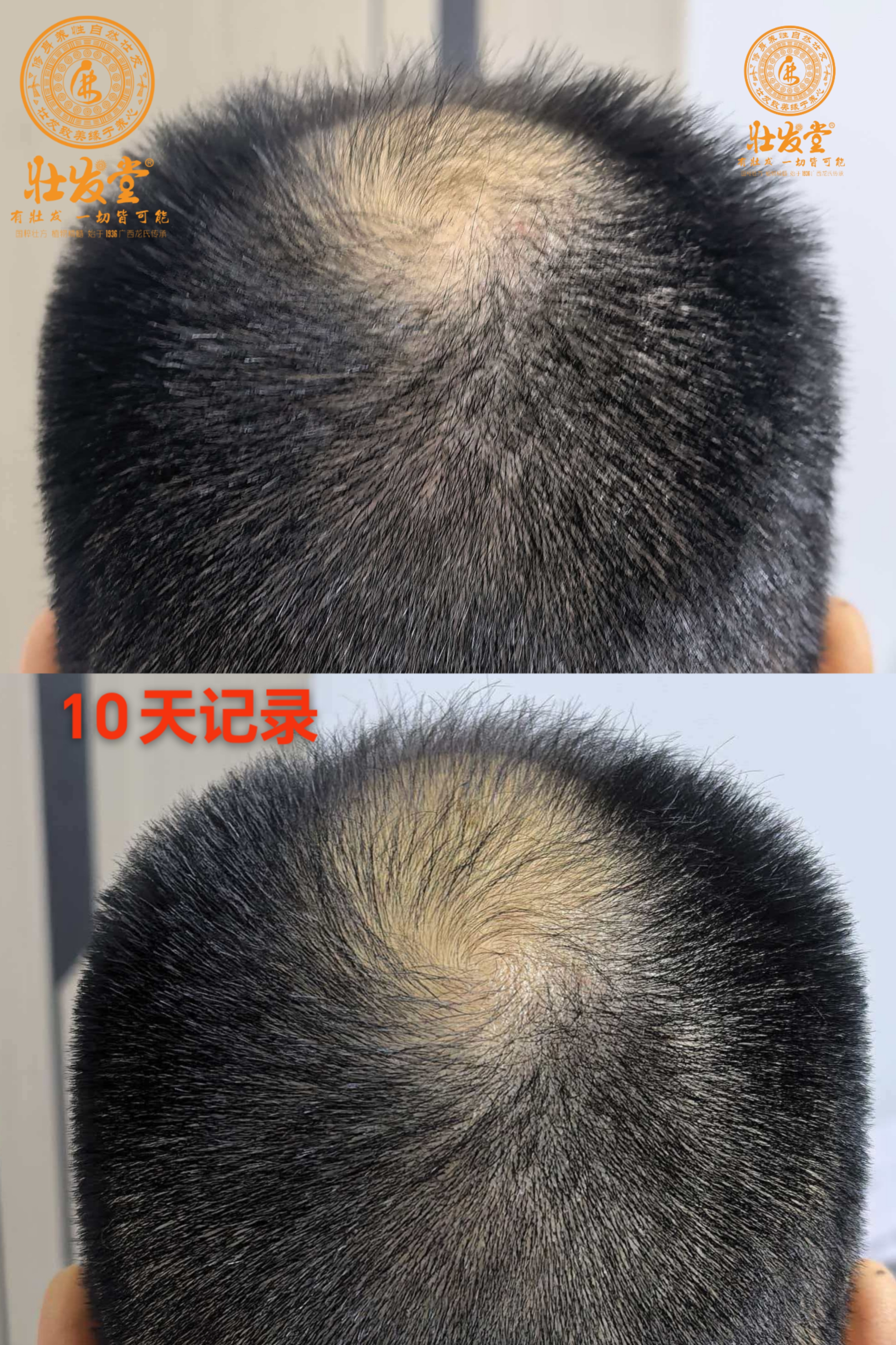 脱养密10天记录