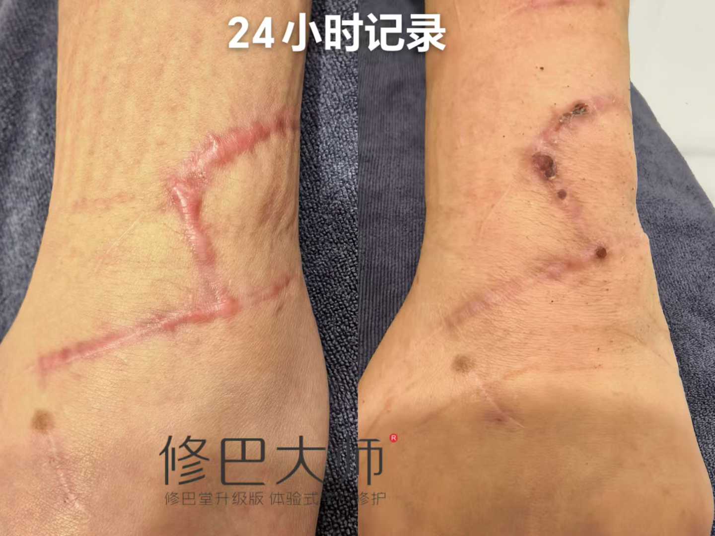 24小时记录