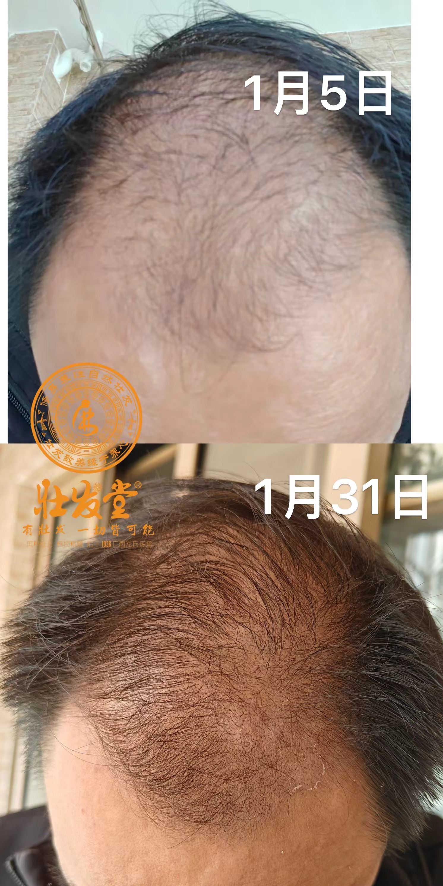 脱养密26天变化